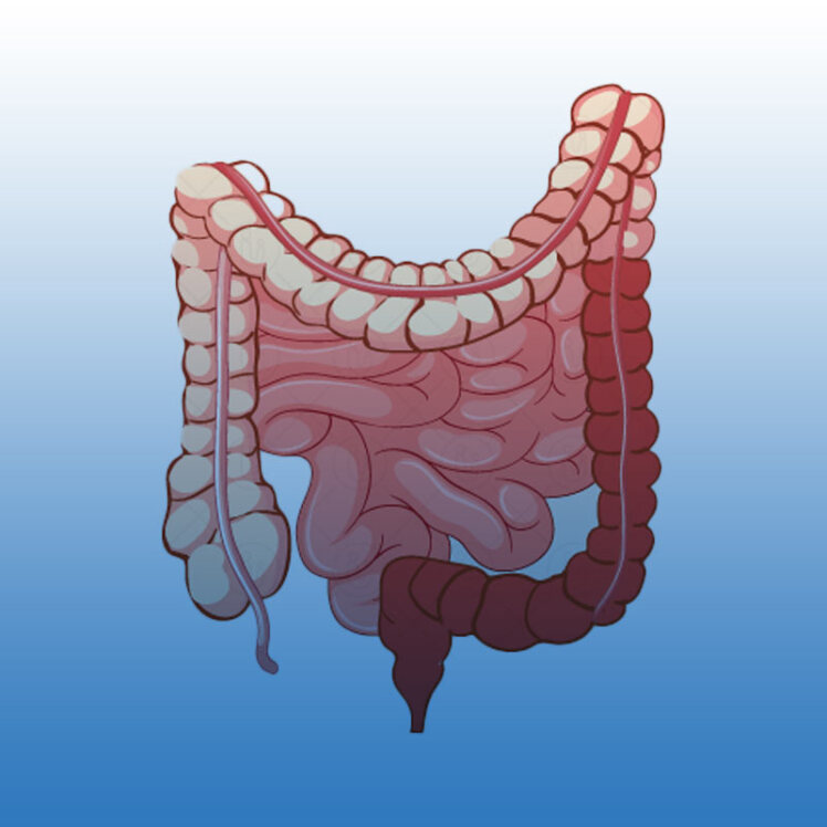 علائم التهاب روده یا IBD چیست؟ تشخیص و درمان