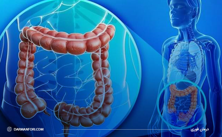 آشنایی با علائم سرطان روده