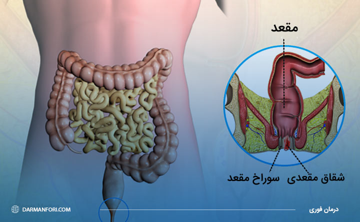 شقاق مقعدی چیست؟