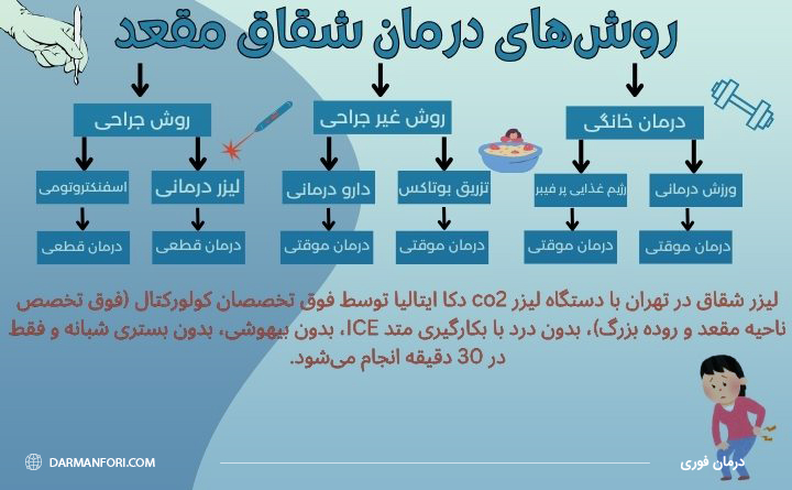 درمان شقاق مقعد با لیزر چگونه است؟