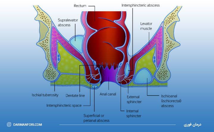  آناتومی آبسه علت برگشت بیماری آبسه مقعدی 