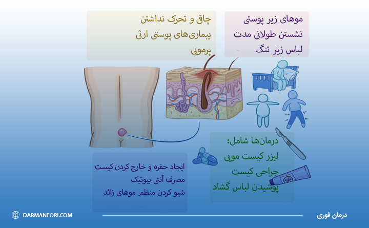 چرا کیست مویی به وجود می آید؟