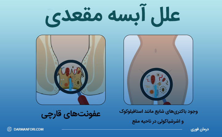 علت های به وجود آمدن آبسه مقعدی