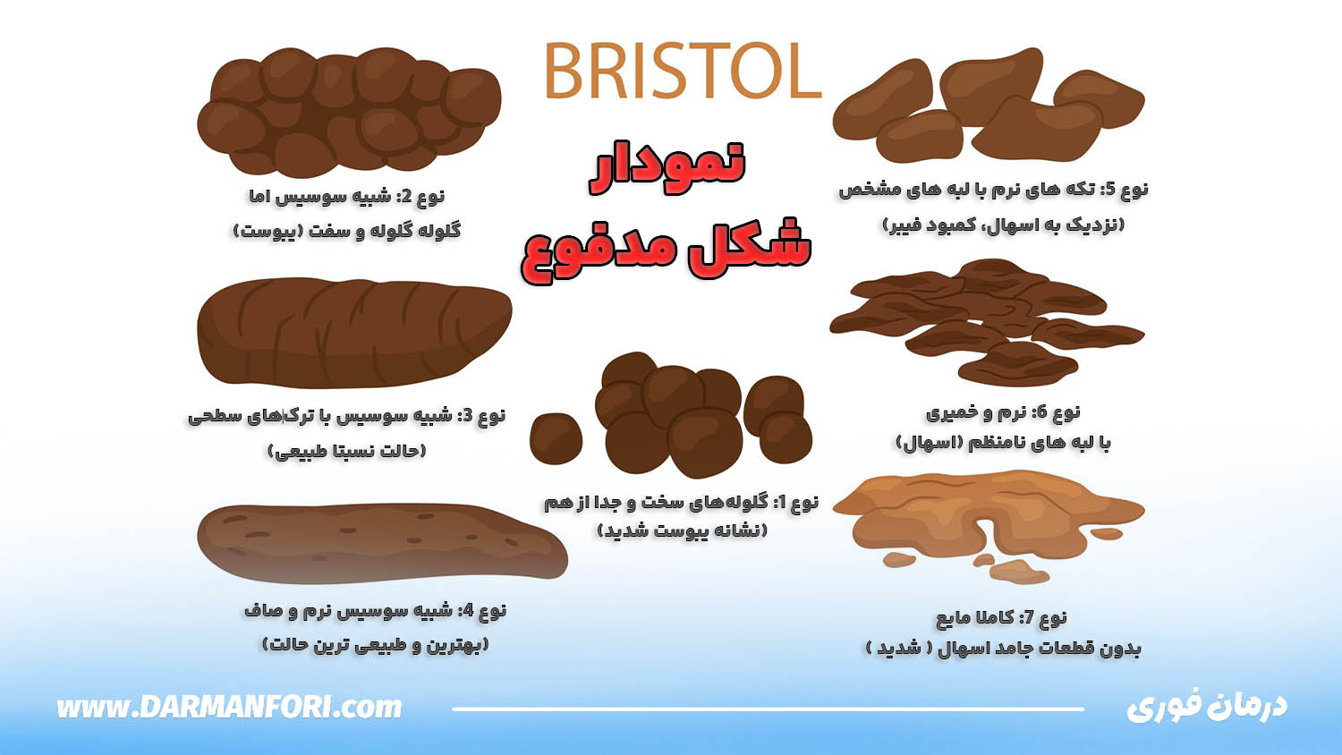 نمودار بریستول برای بررسی انواع شکل مدفوع از یبوست تا اسهال و ارتباط آن با سوزش مقعد