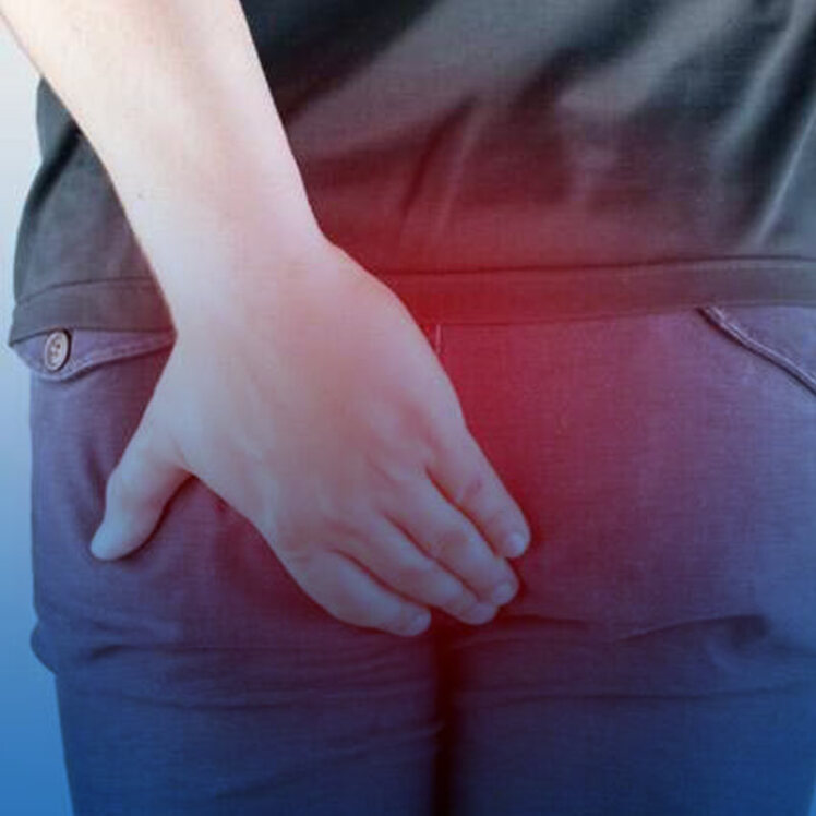 بهترین دکتر فوق تخصص شقاق یا فیشر چه کسی است؟