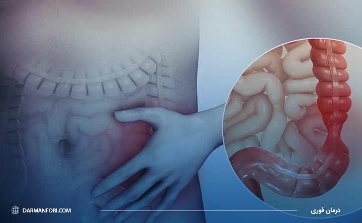 سندروم روده تحریک پذیر از علل بی اشتهایی