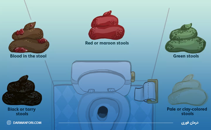 آشنایی با تغییر رنگ مدفوع