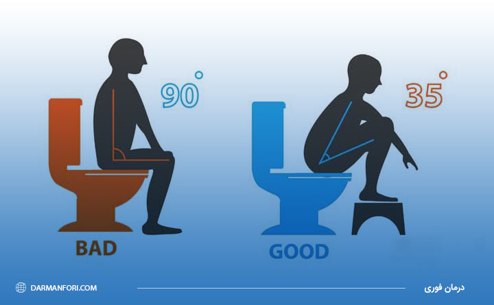 نحوه صحیح نشستن افراد مبتلا به بواسیر در توالت