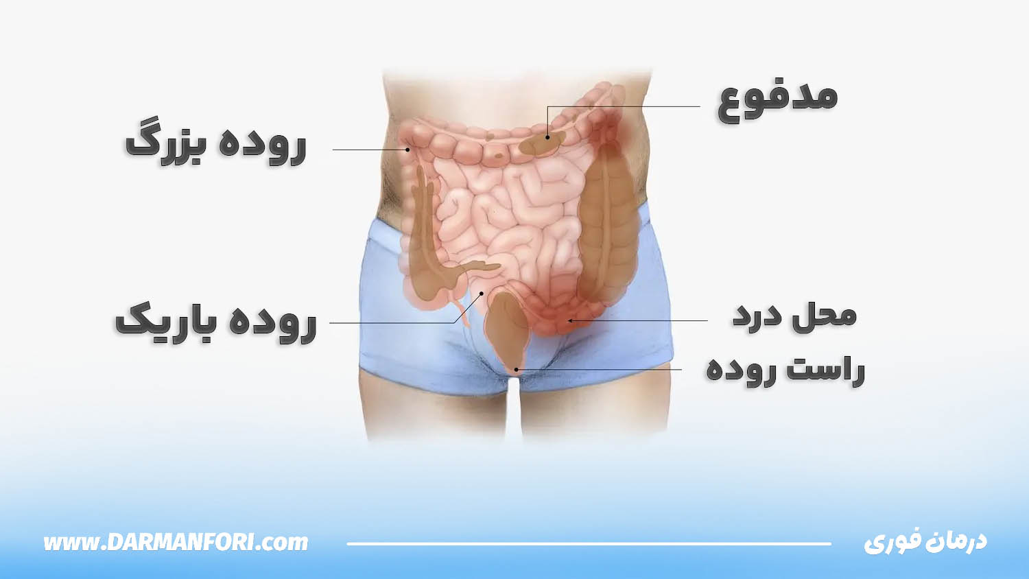 نمایش روده بزرگ و روده باریک و محل درد در راستروده مرتبط با سوزش و درد مقعد بعد از دفع