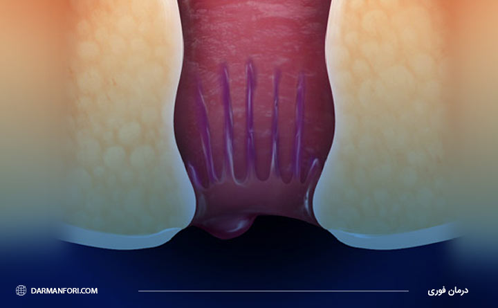 علت بواسیر بعد از زایمان 