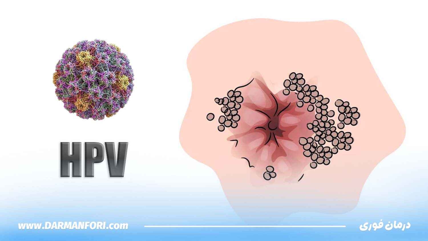 رابطه سکس مقعدی احتمال ابتلا به ویروس پاپیلومای انسانی (HPV) را افزایش می دهد