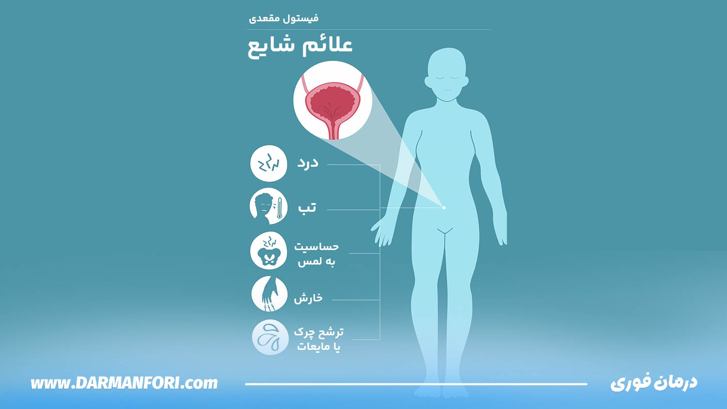 اینفوگرافیک علائم فیستول مقعدی شامل درد، ترشح، تورم