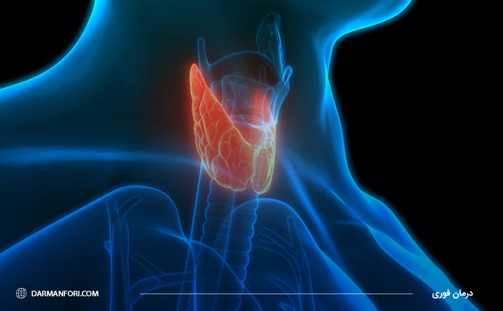 پرکاری تیروئید از انواع بیماری گوارشی
